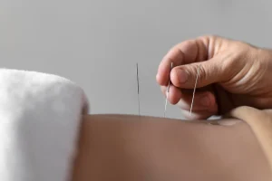 punti agopuntura per dimagrire: agopuntura dimagrire