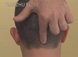 punto di agopuntura bl10 indicato per il mal di testa sulla nuca