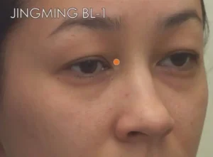il punto di mal di testa interno all'occhio segnato con un puntino rosso