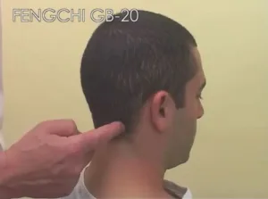 tocco di punto del mal di testa sulla nuca