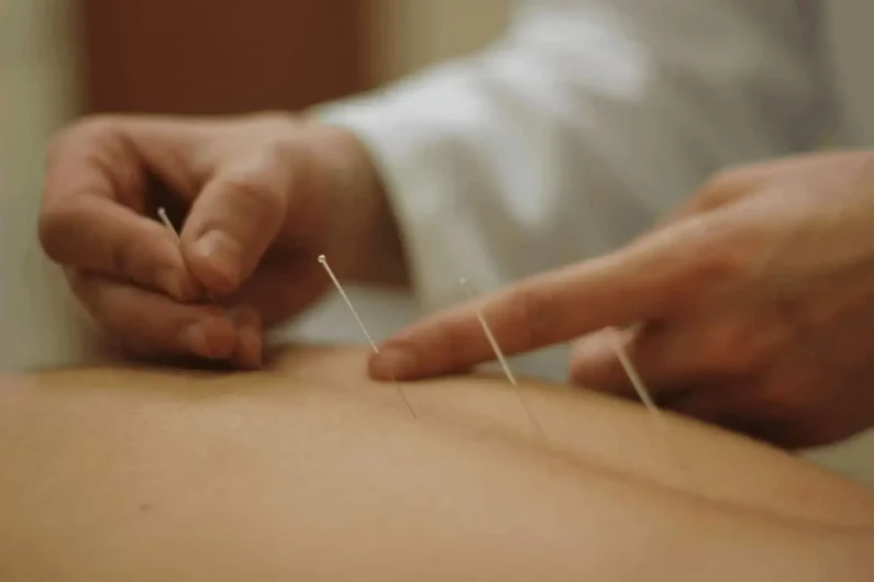 La dottoressa Francese inserisce aghi di agopuntura a un paziente