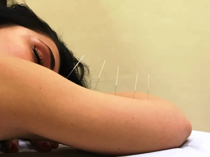 dettaglio di una ragazza in rilassamento prima di venire curate con l'agopuntura per i dolori che le provoca la fibromialgia