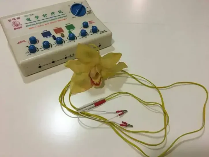 strumenti medici agopuntura: n macchinario per la pratica dell'elettroagopuntura in utilizzo presso Agopuntura Rimini